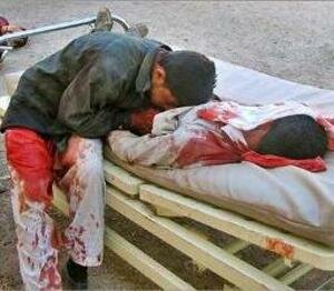 iraqi dying blood